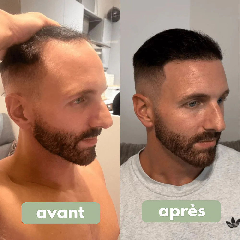 Relief – Sérum Cheveux