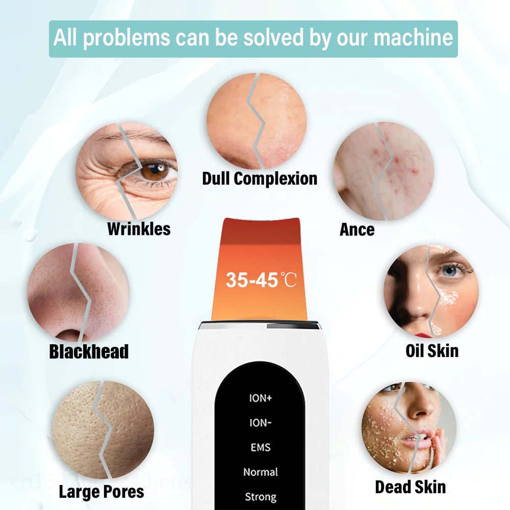 Ultrasonic Blackhead Remover & Skin Rejuvenation Device - Relief