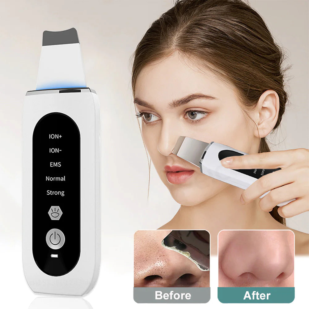 Ultrasonic Blackhead Remover & Skin Rejuvenation Device - Relief