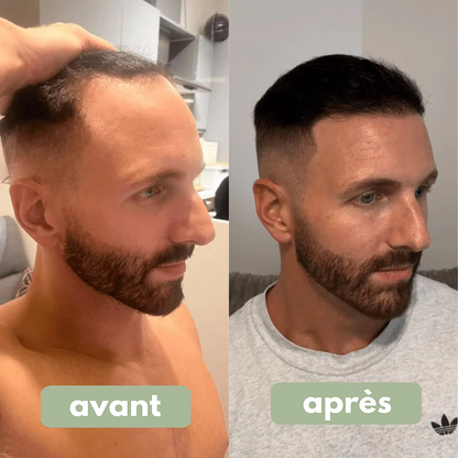 Relief – Sérum Cheveux
