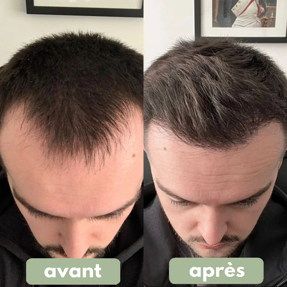 Relief – Sérum Cheveux